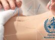 OMS incluye a la medicina china en el índice de salud